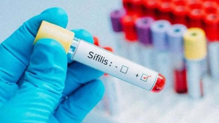 Sífilis: de los últimos casos casi un 50% son jóvenes de 20 a 29 años