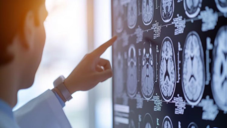 Los científicos identificaron la edad en la que el cerebro se deteriora más rápido